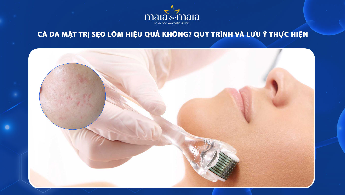 cà da mặt trị sẹo lõm