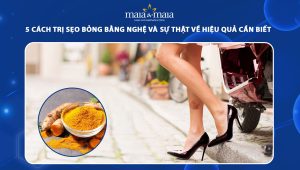 cách trị sẹo bỏng bằng nghệ