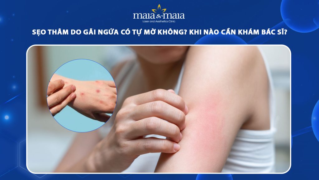 Sẹo thâm do gãi ngứa có tự mờ không? Khi nào cần khám bác sĩ? 1 sẹo thâm do gãi ngứa