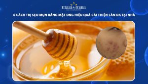 trị sẹo mụn bằng mật ong