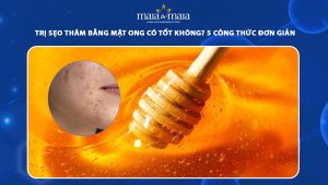 trị sẹo thâm bằng mật ong