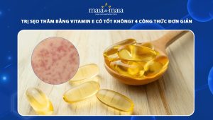 trị sẹo thâm bằng vitamin e
