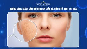 cách làm mờ sẹo