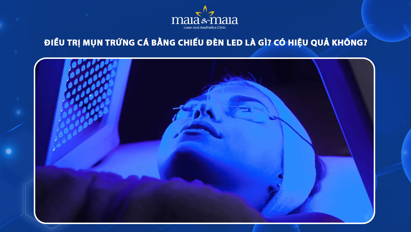 điều trị mụn trứng cá bằng chiếu đèn LED