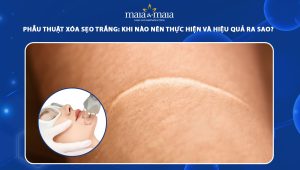 phẫu thuật xóa sẹo trắng