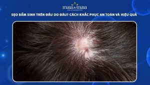 sẹo bẩm sinh trên đầu