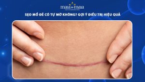 sẹo mổ đẻ