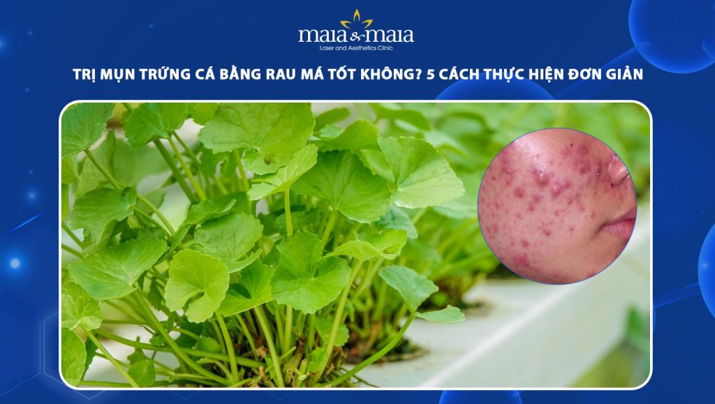 Trị mụn trứng cá bằng rau má tốt không? 5 cách thực hiện đơn giản 1 trị mụn trứng cá bằng rau má