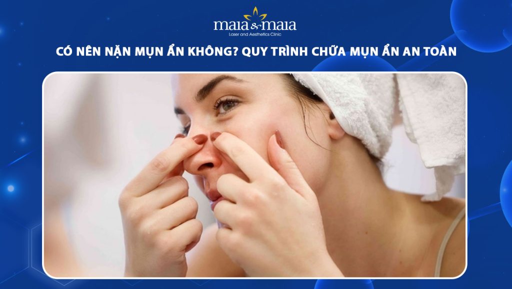 có nên nặn mụn ẩn không