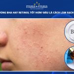 mụn ẩn nên dùng BHA hay retinol