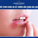 mụn nước ở môi kiêng ăn gì