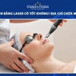 trị mụn ẩn bằng laser