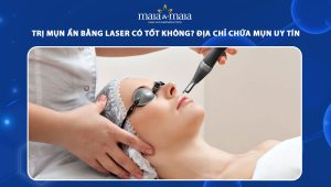 trị mụn ẩn bằng laser
