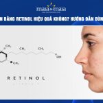 trị mụn ẩn bằng retinol