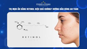 trị mụn ẩn bằng retinol