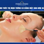 trị mụn trứng cá bằng mật ong