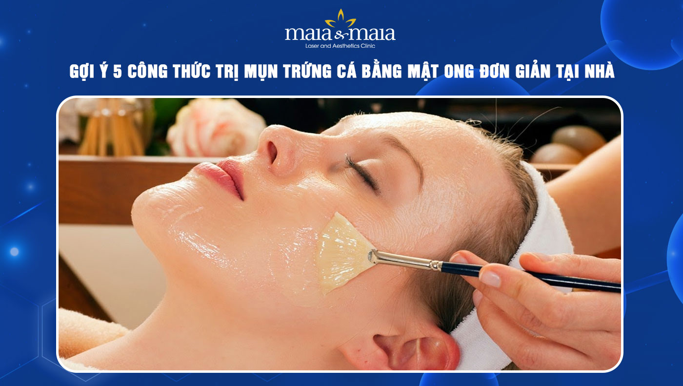 trị mụn trứng cá bằng mật ong
