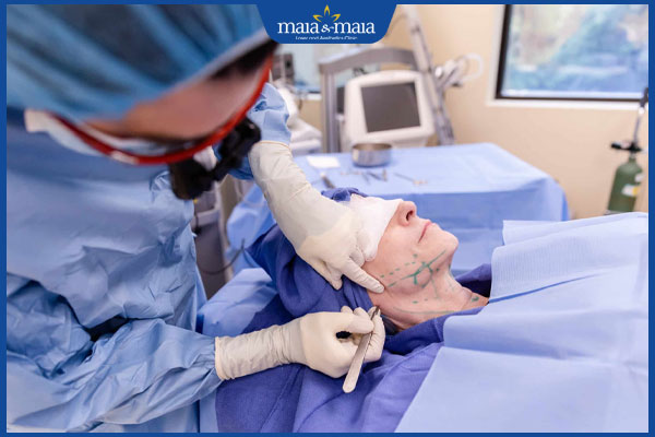 Nâng cơ mặt 3 phẫu thuật nâng cơ mặt