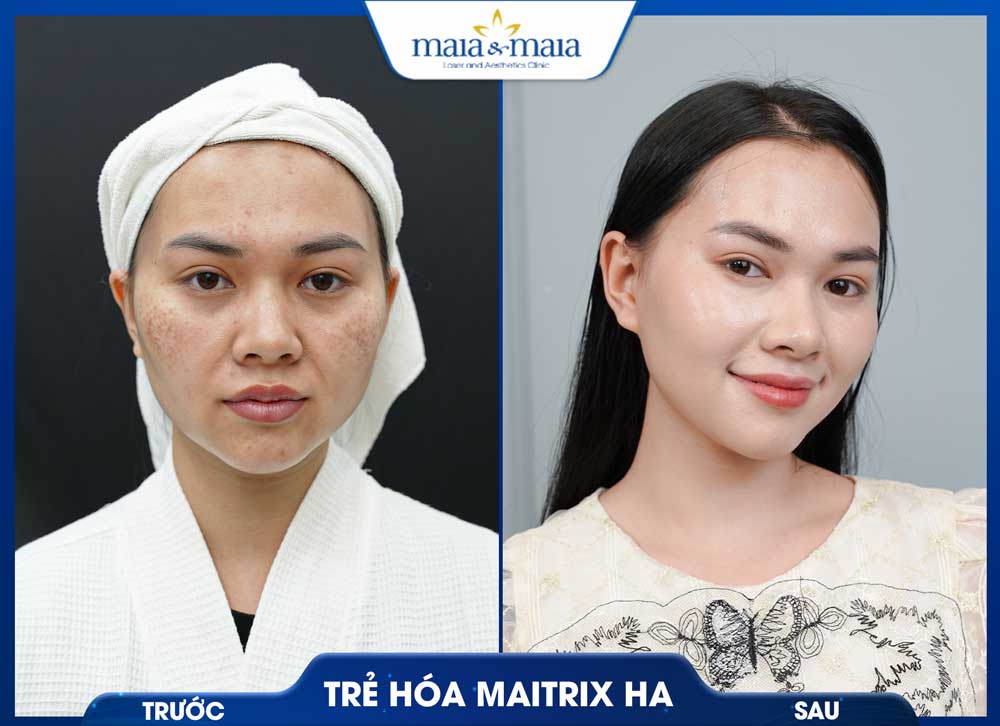 Trang chủ 48 trc sau1