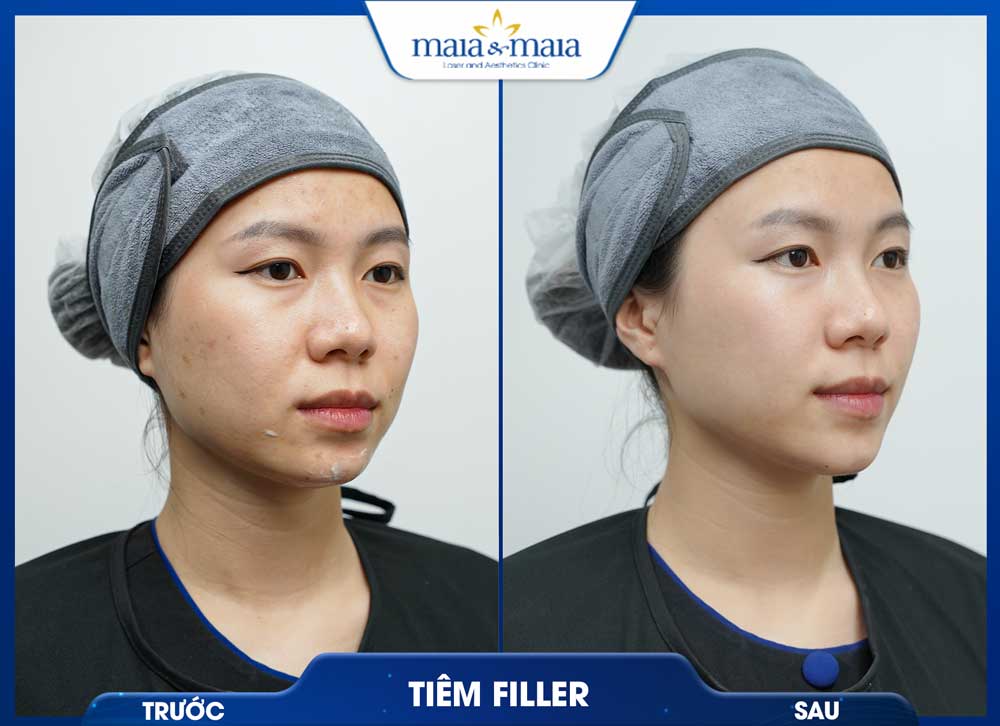 Trang chủ 49 trc sau2