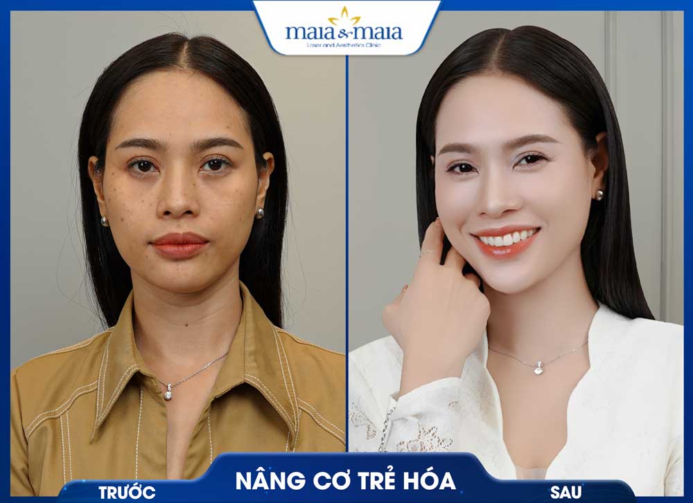 Trang chủ 50 trc sau3