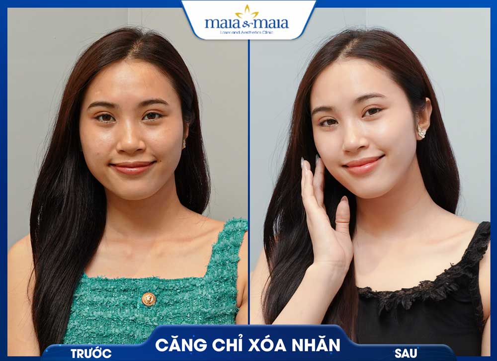 Trang chủ 52 trc sau4