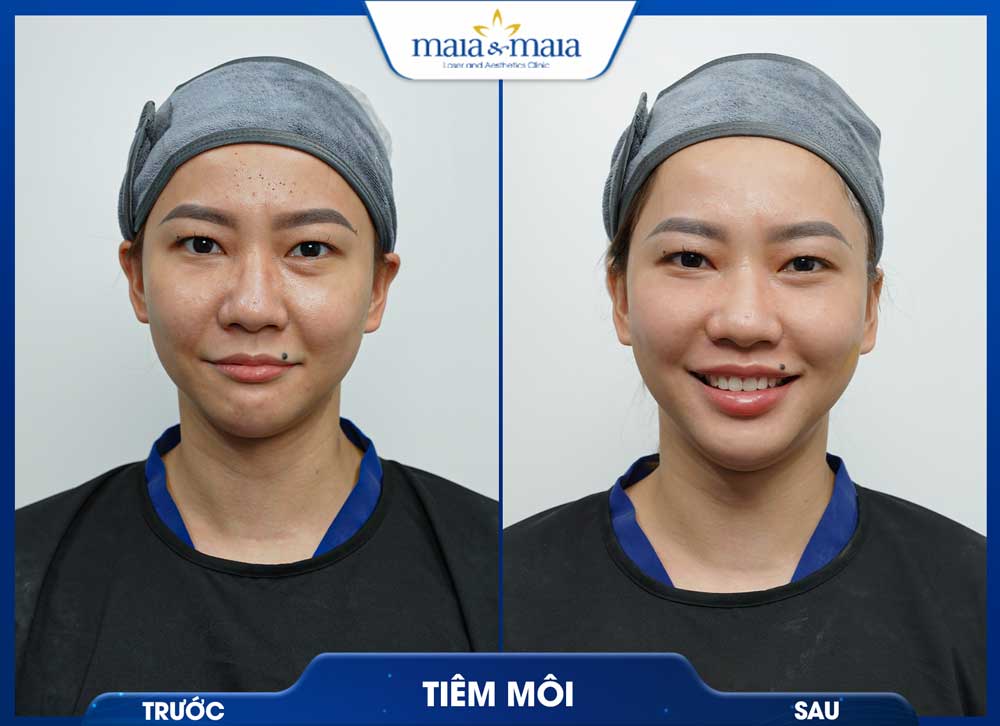 Trang chủ 51 trc sau5