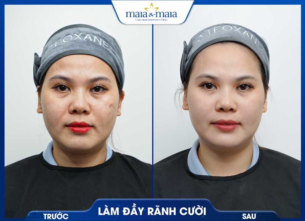 Trang chủ 53 trc sau6