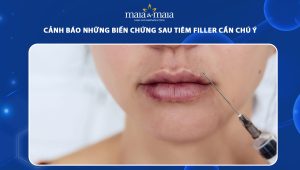 Cảnh báo những biến chứng sau tiêm filler cần chú ý 61 biến chứng sau tiêm filler