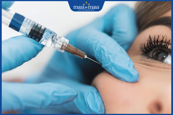 Tiêm filler má là gì? Có đắt không? Địa chỉ thực hiện uy tín 4 chi phí tiêm filler má