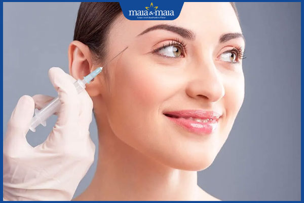 Tiêm filler thái dương: Giải pháp cho gương mặt đầy đặn, trẻ trung 2 filler thái dương