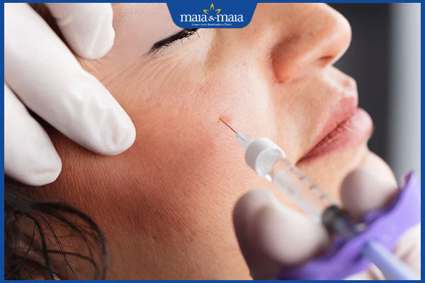Tiêm filler xong bị ngứa có sao không? Cách giảm ngứa hiệu quả 2 kỹ thuật tiêm filler ở má