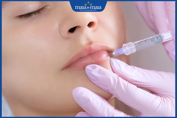 Tiêm tan filler bao lâu tiêm lại được? Cần lưu ý những gì? 3 lưu ý khi tiêm lại filler