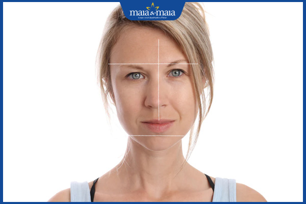 Tiêm filler mặt lệch: Giải pháp cho gương mặt cân đối không phẫu thuật 2 mặt lệch
