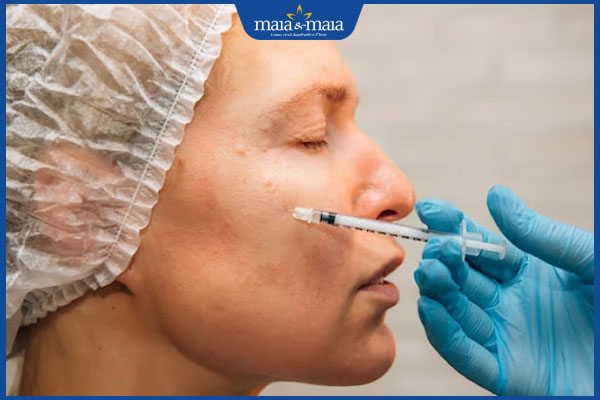 Có nên tiêm filler làm đầy sẹo lõm không? Địa chỉ thực hiện an toàn 2 thực hiện tiêm filler làm đầy sẹo lõm