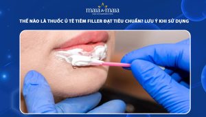 Thế nào là thuốc ủ tê tiêm filler đạt tiêu chuẩn? Lưu ý khi sử dụng 32 thuốc ủ tê tiêm filler