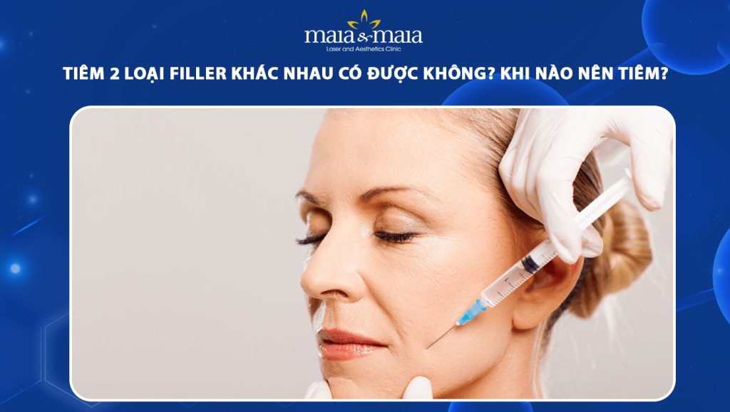 Tiêm 2 loại filler khác nhau có được không? Khi nào nên tiêm? 1 tiêm 2 loại filler khác nhau
