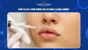 Tiêm filler 2 năm không tan có đáng lo ngại không? 66 tiêm filler 2 năm không tan