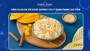 Tiêm filler ăn xôi được không? Lưu ý quan trọng sau tiêm filler 94 tiêm filler ăn xôi được không