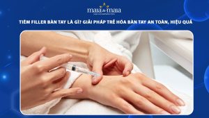 Tiêm filler bàn tay: Giải pháp trẻ hóa tay an toàn, hiệu quả  68 tiêm filler bàn tay