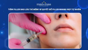 Tiêm filler bao lâu thì mềm? Bí quyết để filler nhanh đẹp tự nhiên 54 tiêm filler bao lâu thì mềm