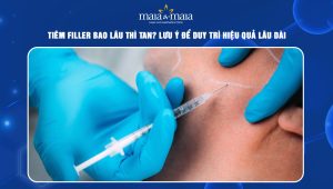 Tiêm filler bao lâu thì tan? Lưu ý để duy trì hiệu quả lâu dài 38 tiêm filler bao lâu thì tan