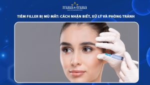 Tiêm filler bị mù mắt: Cách nhận biết, xử lý và phòng tránh 59 tiêm filler bị mù mắt
