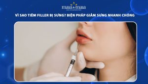 Vì sao tiêm filler bị sưng? Biện pháp giảm sưng nhanh chóng 57 tiêm filler bị sưng