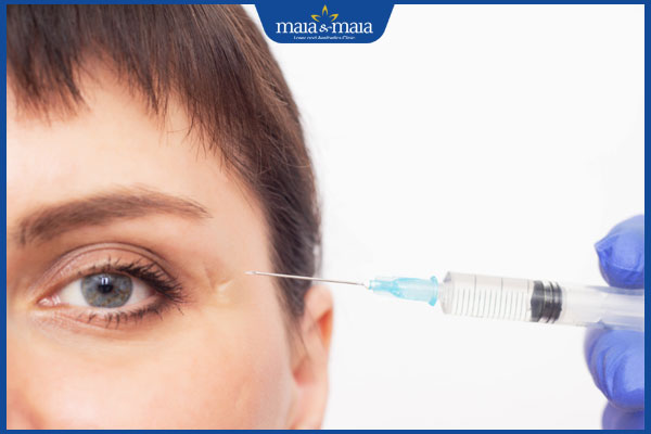 Có nên tiêm filler làm đầy sẹo lõm không? Địa chỉ thực hiện an toàn 4 tiêm filler cho sẹo lõm