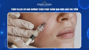 Tiêm filler có đau không? Biện pháp giảm đau hiệu quả khi tiêm 41 Tiêm filler có đau không