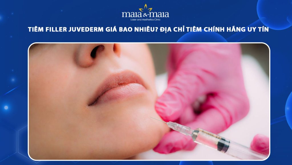 tiêm filler juvederm giá bao nhiêu