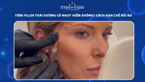 Tiêm filler thái dương có nguy hiểm không? Cách hạn chế rủi ro 44 tiêm filler thái dương có nguy hiểm không