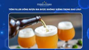 Tiêm filler uống rượu bia được không? Kiêng trong bao lâu? 87 tiêm filler uống rượu bia được không