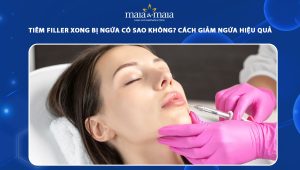 Tiêm filler xong bị ngứa có sao không? Cách giảm ngứa hiệu quả 88 tiêm filler xong bị ngứa